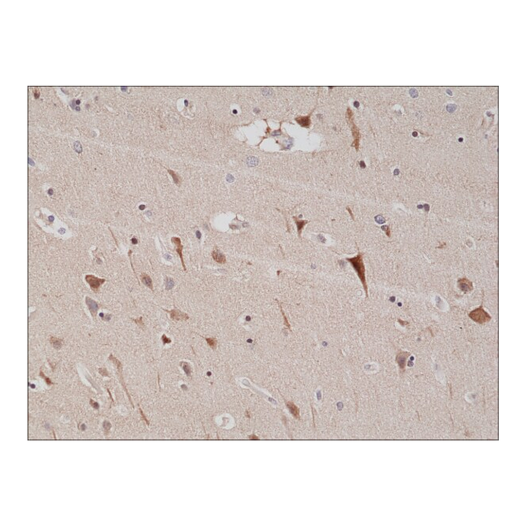Merck Anti-PSD-95 antibody, Rabbit Monoclonal