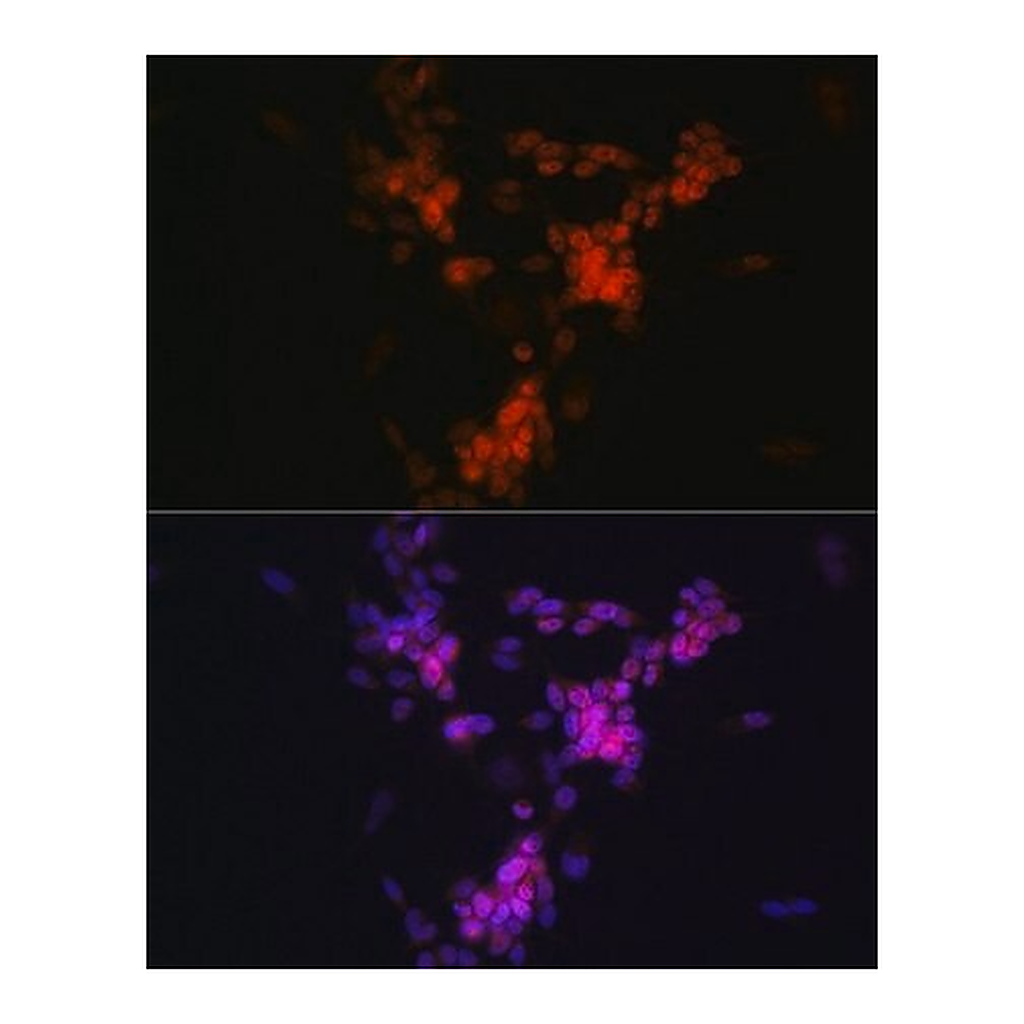 Merck Anti-CHAT antibody produced in rabbit
