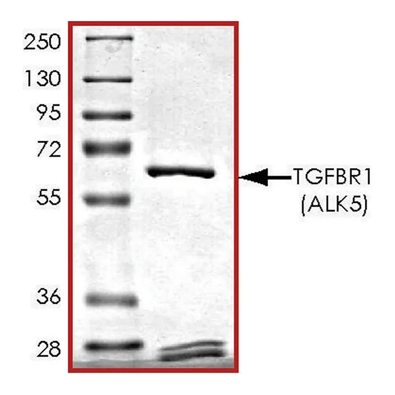 Merck TGFbetaR1 (80-end), active, GST tagged human