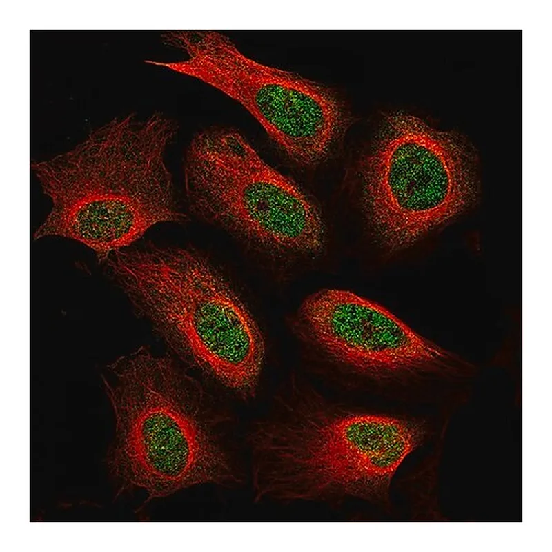 Merck Monoclonal Anti-NF1 antibody produced in mouse