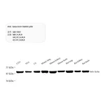 Servicebio Anti -beta Actin Rabbit pAb