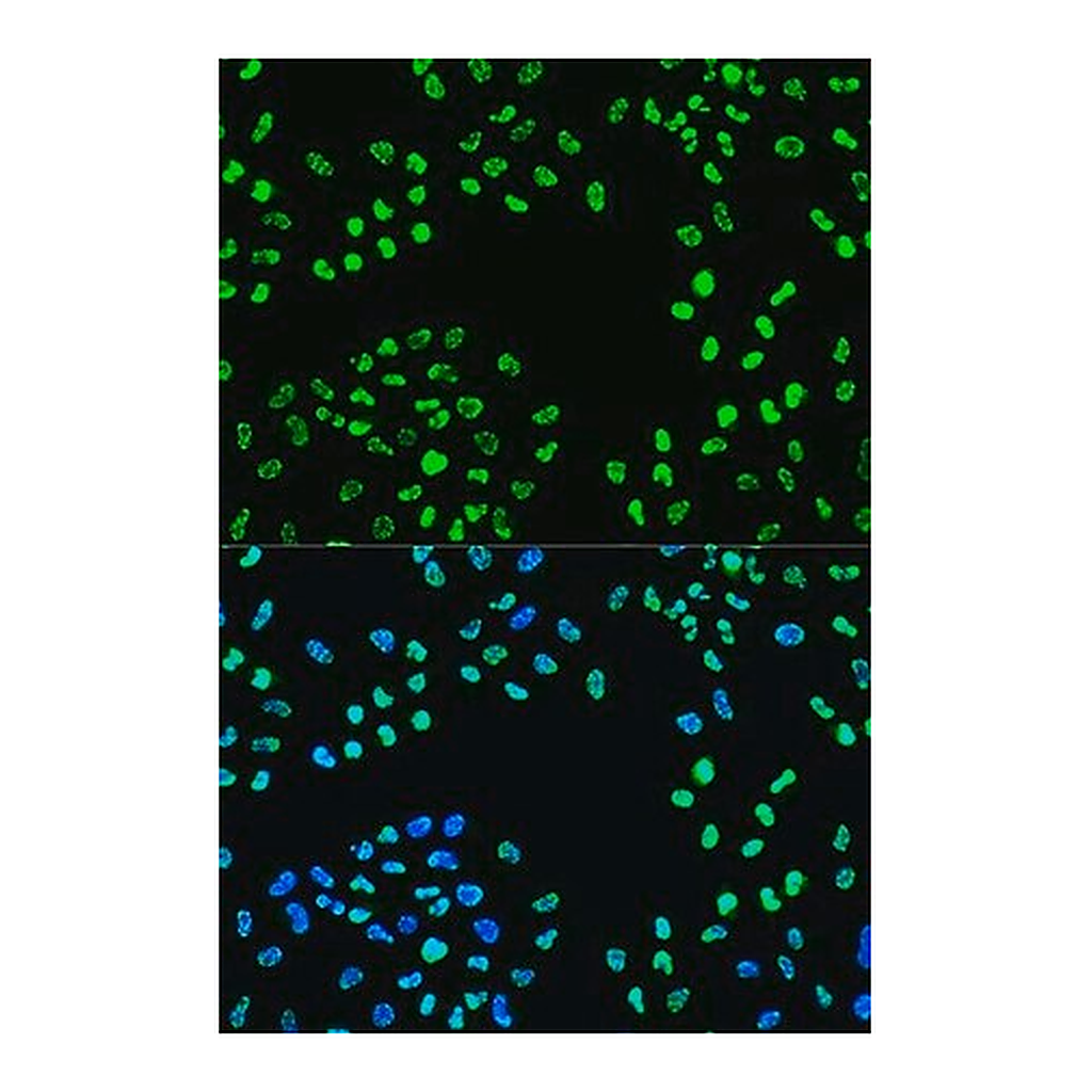 Merck Anti-Phospho-ATR-S428 antibody produced in rabbit
