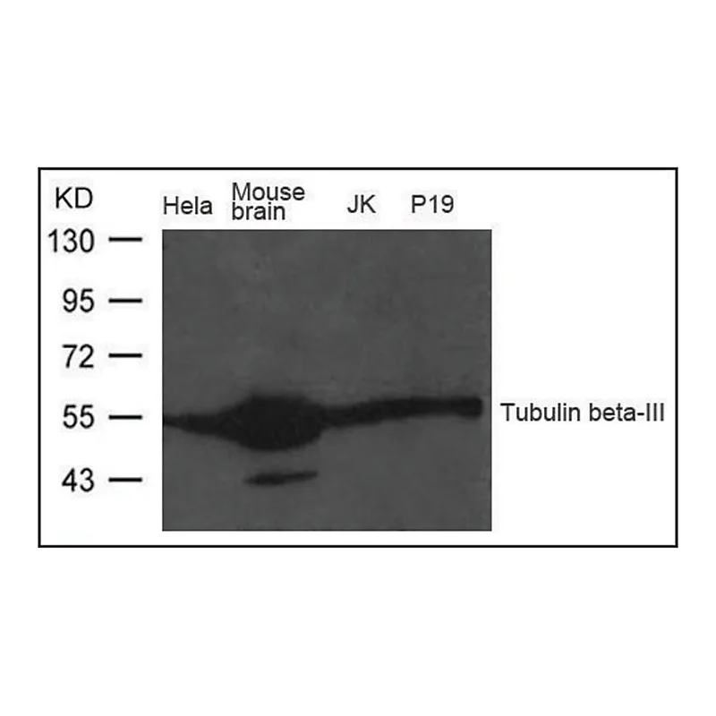Merck Anti-Tubulin beta-III antibody produced in rabbit