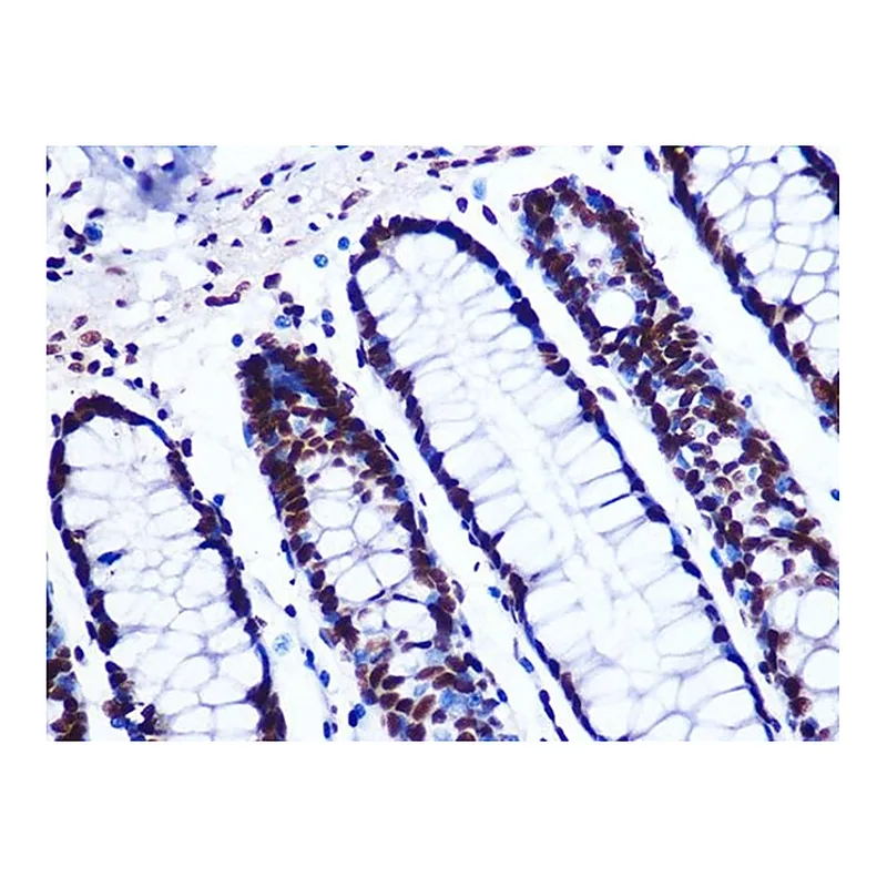 Merck Anti-GTPBP4 antibody produced in rabbit