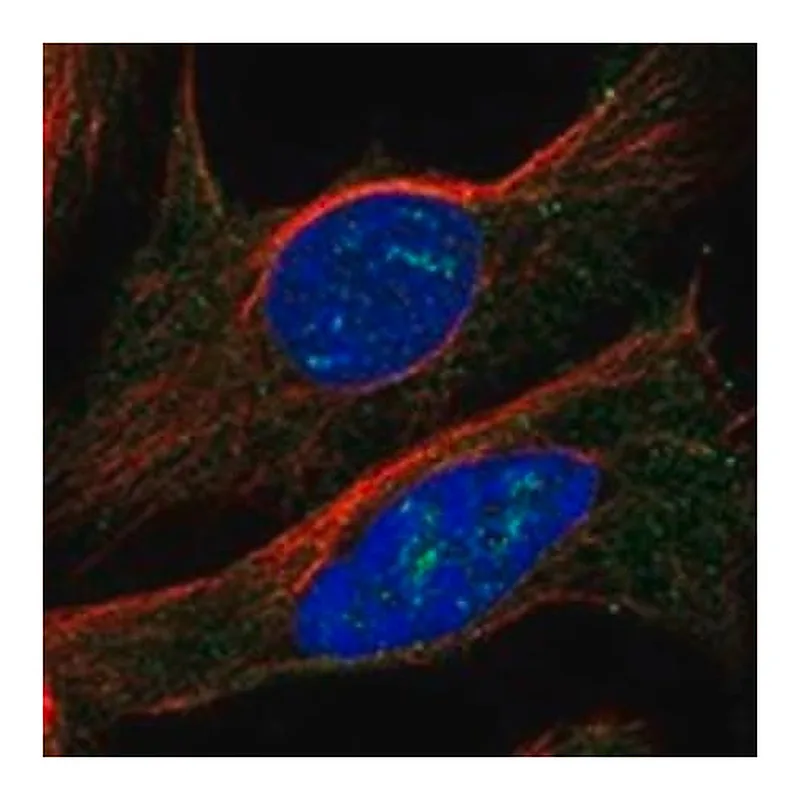 Merck Anti-CLN6 antibody produced in rabbit