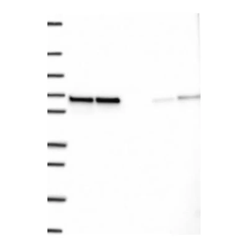 Merck Anti-CCDC47 antibody produced in rabbit