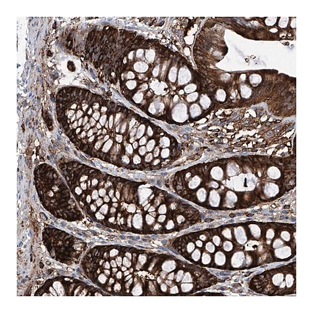 Merck Anti-ZNF484 antibody produced in rabbit