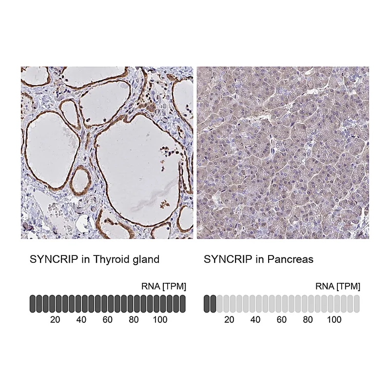 Atlas Antibodies Anti-SYNCRIP Antibody