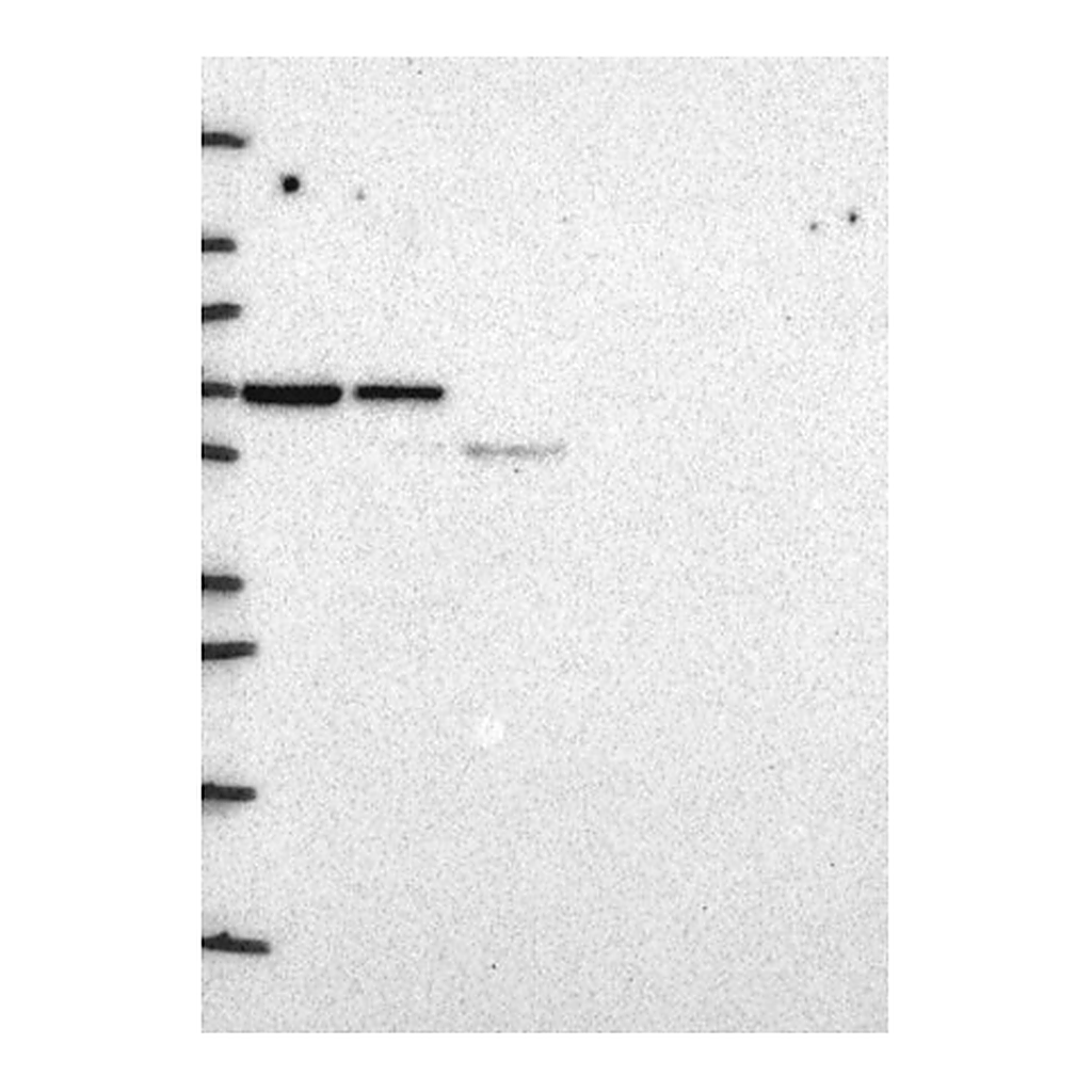 Atlas Antibodies Anti-SYNCRIP Antibody