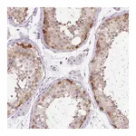 Atlas Antibodies Anti-SYNE3 Antibody