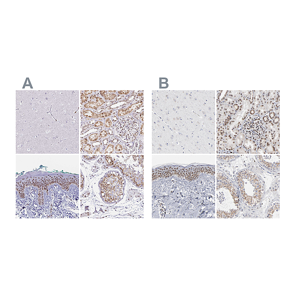 Atlas Antibodies Anti-SYNE2 Antibody