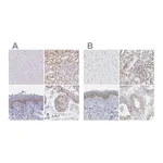 Atlas Antibodies Anti-SYNE2 Antibody
