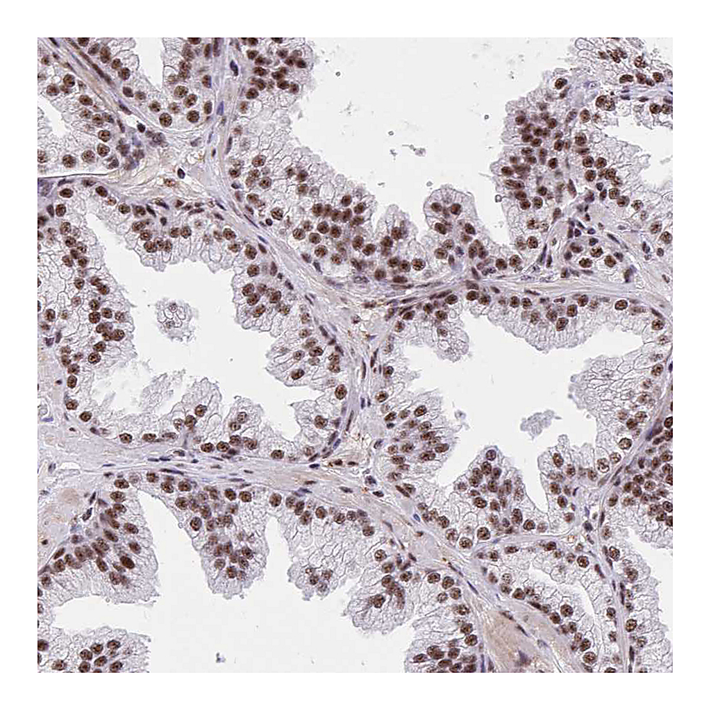 Atlas Antibodies Anti-SYNE4 Antibody