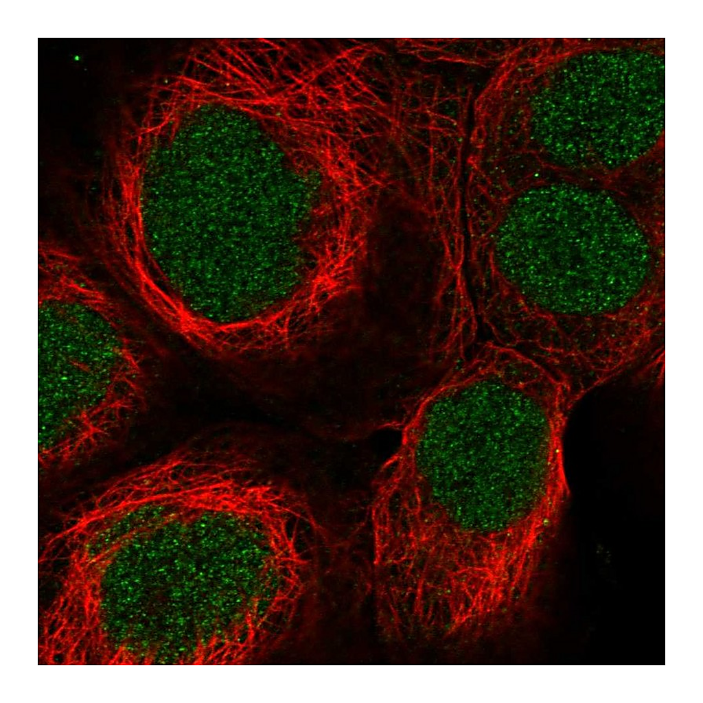 Atlas Antibodies Anti-SYNGAP1 Antibody