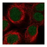 Atlas Antibodies Anti-SYNGAP1 Antibody