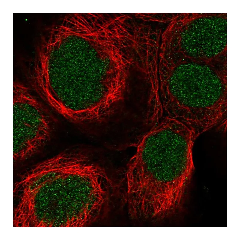 Atlas Antibodies Anti-SYNGAP1 Antibody