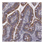 Atlas Antibodies Anti-SYNJ2BP Antibody
