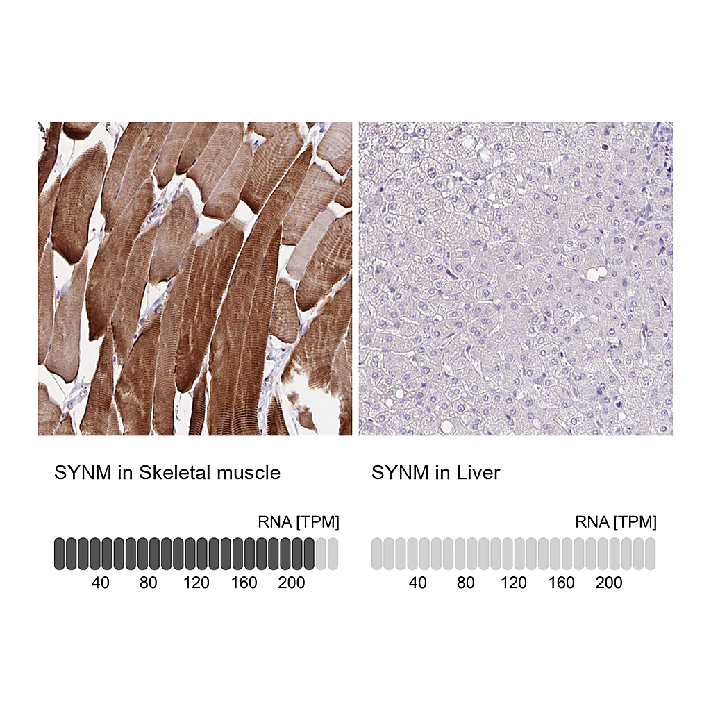 Atlas Antibodies Anti-SYNM Antibody