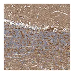 Atlas Antibodies Anti-SYNJ1 Antibody