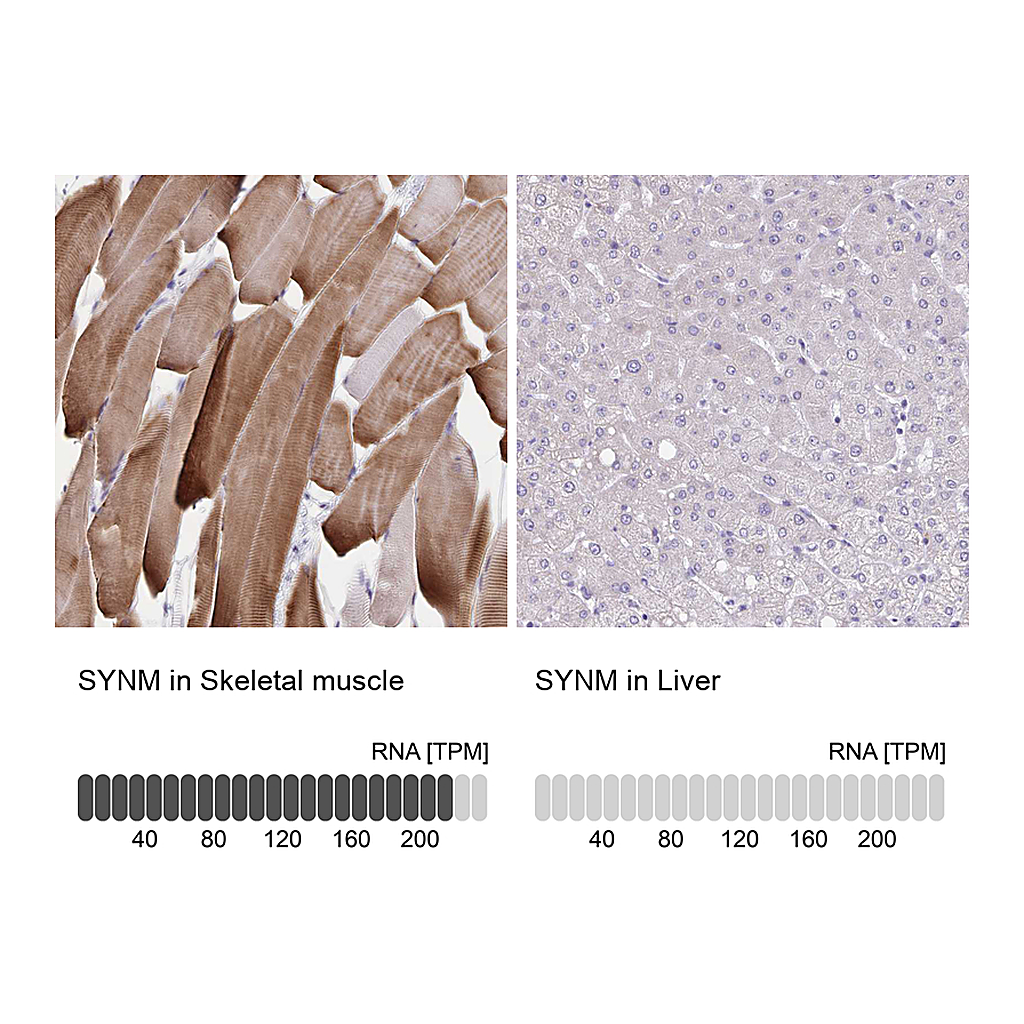 Atlas Antibodies Anti-SYNM Antibody