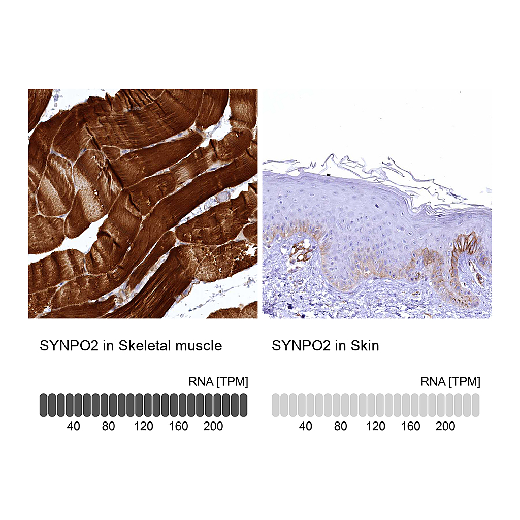 Atlas Antibodies Anti-SYNPO2 Antibody