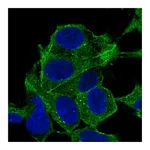 Atlas Antibodies Anti-SYNPO2 Antibody