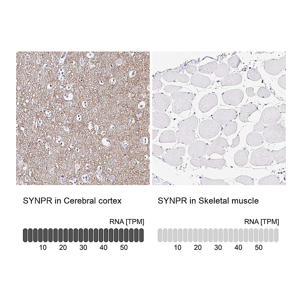 Atlas Antibodies Anti-SYNPR Antibody