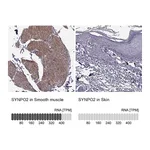 Atlas Antibodies Anti-SYNPO2 Antibody