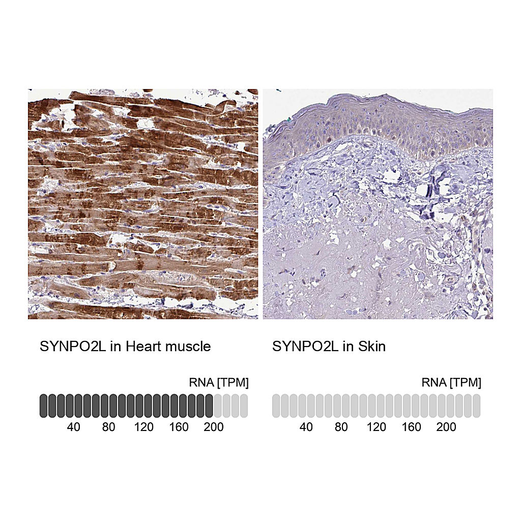 Atlas Antibodies Anti-SYNPO2L Antibody
