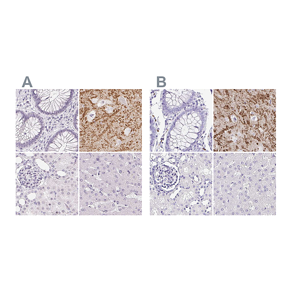 Atlas Antibodies Anti-SYNPR Antibody