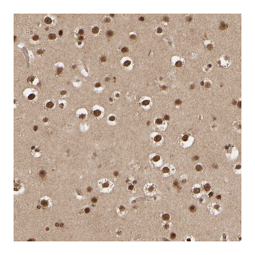 Atlas Antibodies Anti-SYNRG Antibody