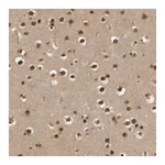 Atlas Antibodies Anti-SYNRG Antibody