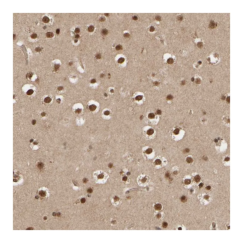 Atlas Antibodies Anti-SYNRG Antibody