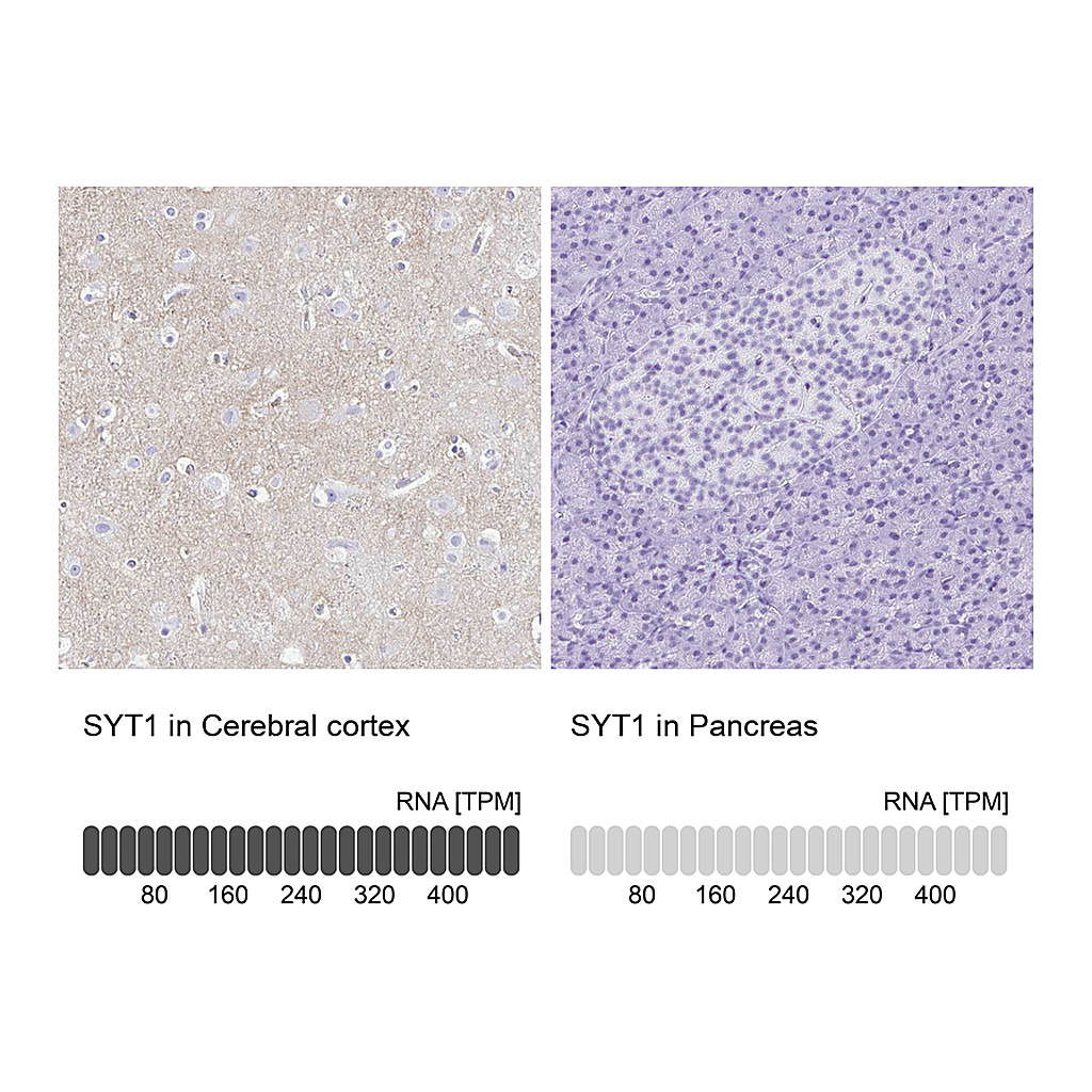 Atlas Antibodies Anti-SYT1 Antibody