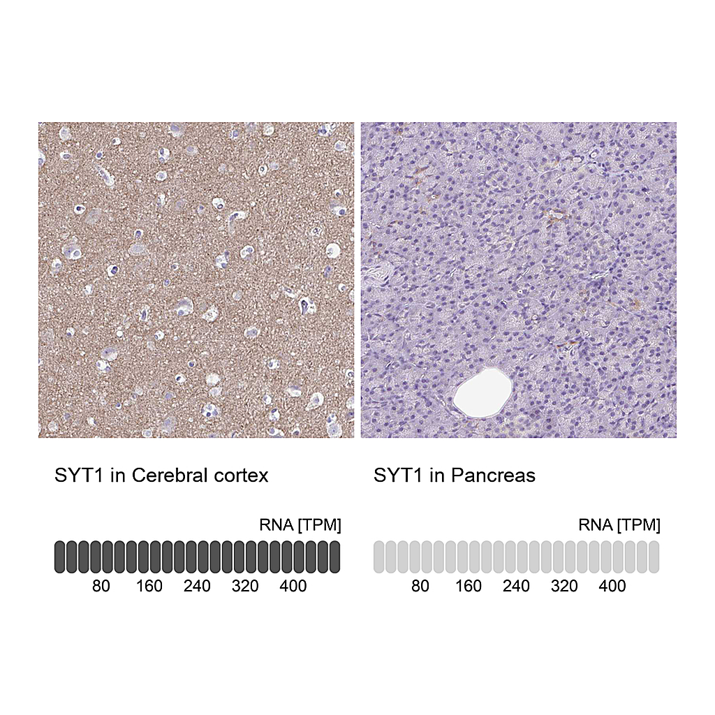 Atlas Antibodies Anti-SYT1 Antibody