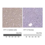 Atlas Antibodies Anti-SYT1 Antibody