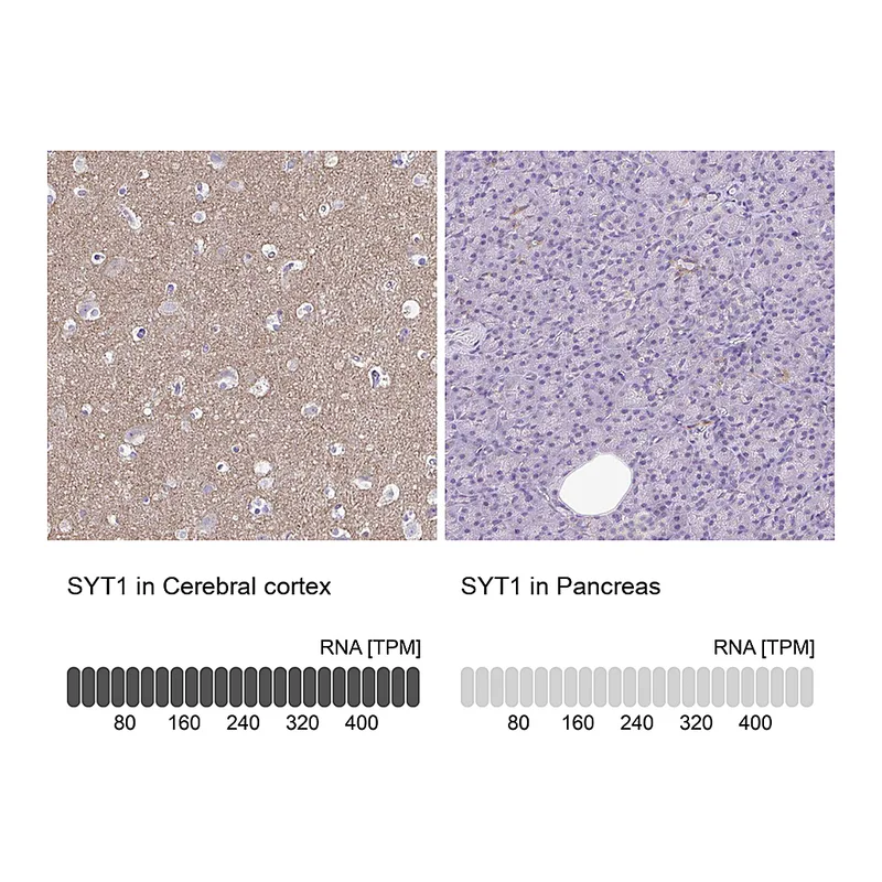 Atlas Antibodies Anti-SYT1 Antibody