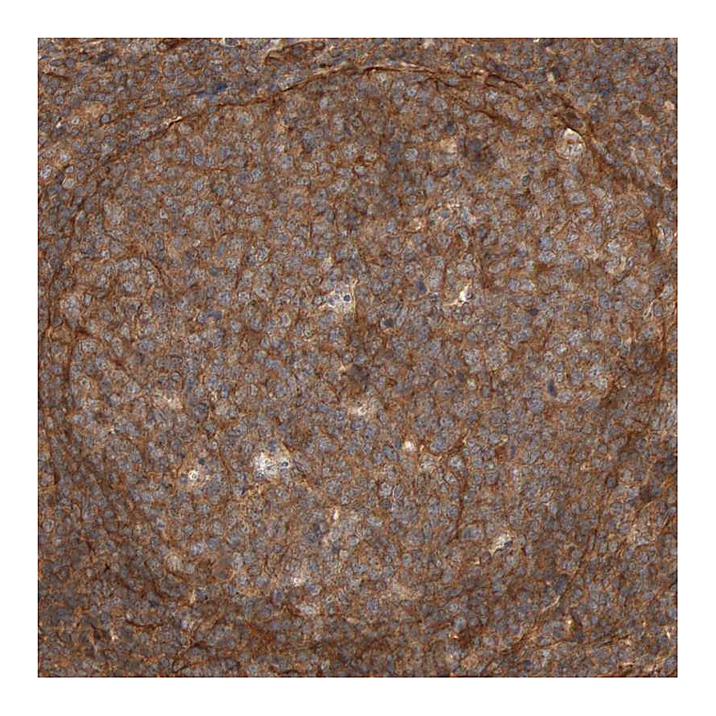 Atlas Antibodies Anti-SYNRG Antibody