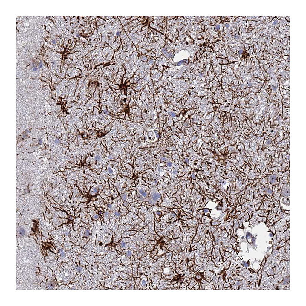 Atlas Antibodies Anti-SYT13 Antibody