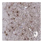 Atlas Antibodies Anti-SYT13 Antibody
