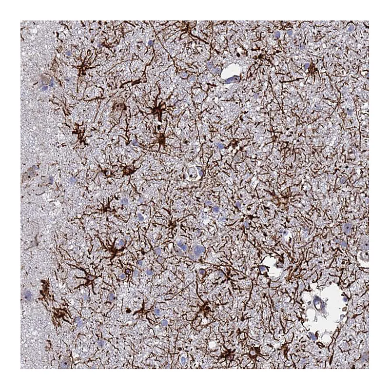 Atlas Antibodies Anti-SYT13 Antibody