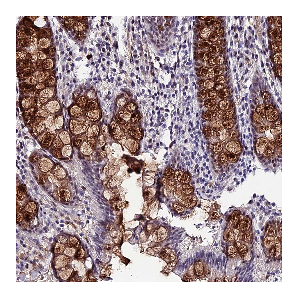 Atlas Antibodies Anti-SYT15 Antibody