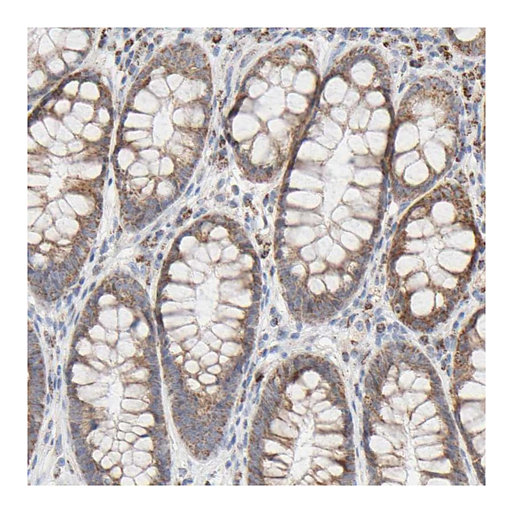 Atlas Antibodies Anti-SYT16 Antibody