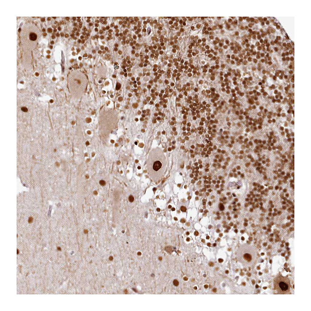 Atlas Antibodies Anti-SYT15 Antibody