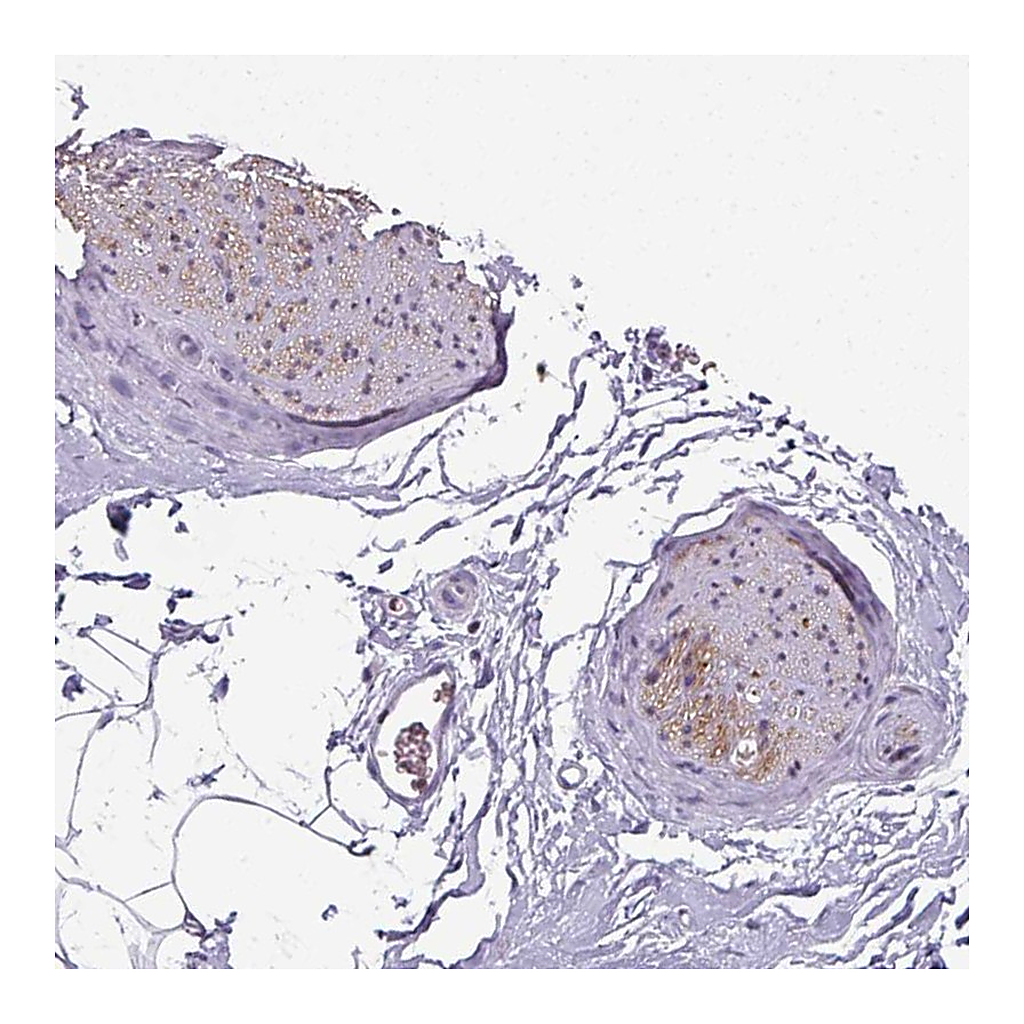 Atlas Antibodies Anti-SYT8 Antibody