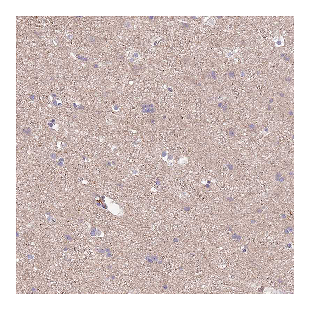 Atlas Antibodies Anti-SYT4 Antibody