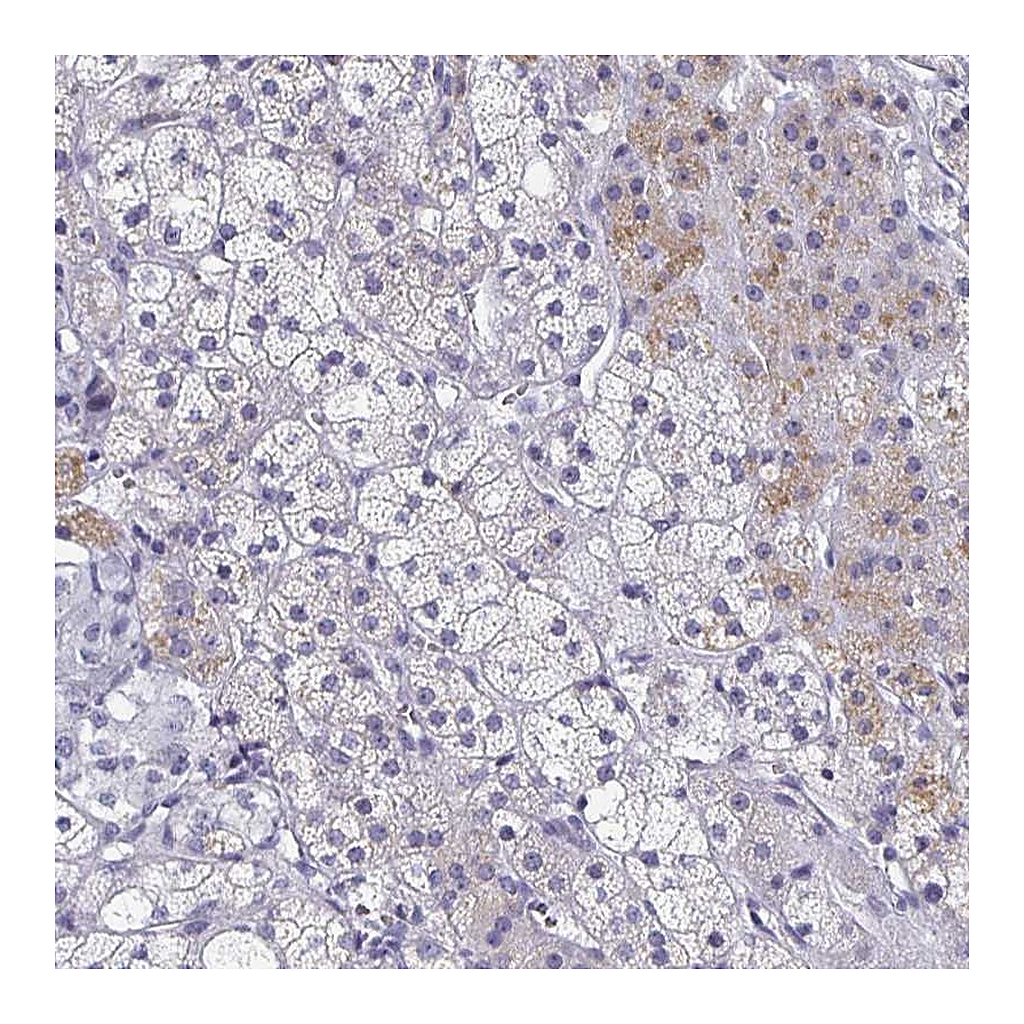 Atlas Antibodies Anti-SYT2 Antibody