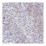 Atlas Antibodies Anti-SYT2 Antibody