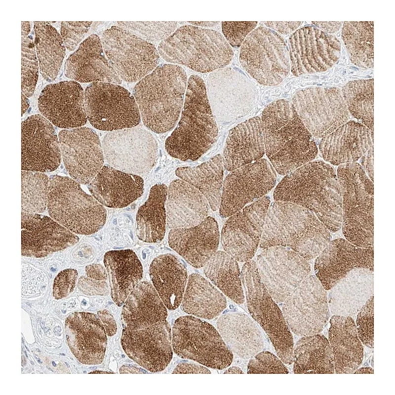 Atlas Antibodies Anti-SYTL3 Antibody