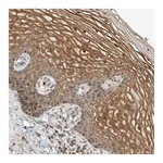 Atlas Antibodies Anti-SYTL3 Antibody